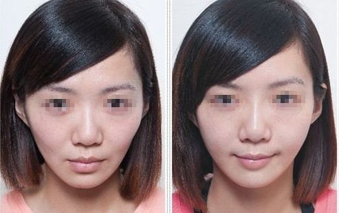 深圳常青樹醫(yī)療美容怎么樣？真實口碑+價格表公開透明！