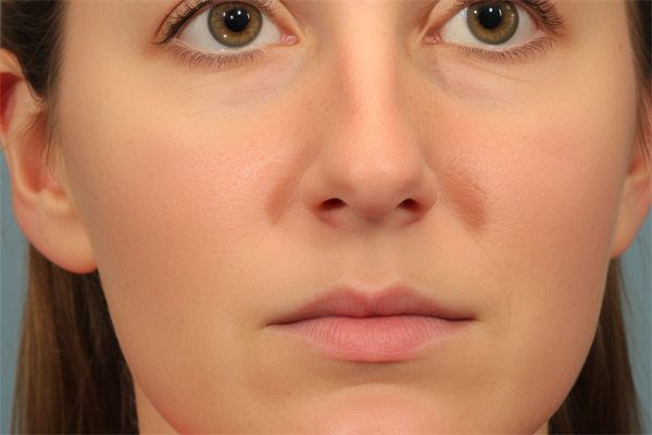 臨沂市哪家公立眼科醫(yī)院好？盤點5家科室，近視矯正價格參考！