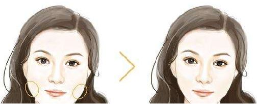 湖南省二醫(yī)皮膚美容科綜合評(píng)測(cè) 醫(yī)院資訊、專家推薦與價(jià)格揭秘